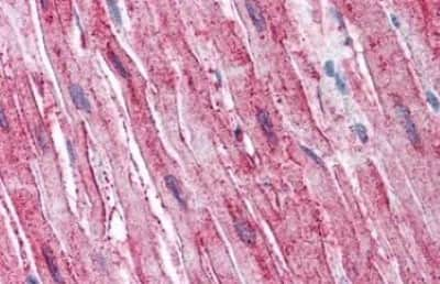 Immunohistochemistry-Paraffin: ADAMTS4 Antibody [NBP3-14532]